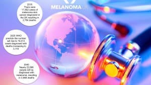 2020 MELANOMA SKIN CANCER REPORT